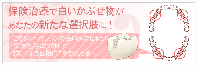 レジンの白い被せ物が該当箇所のみ保険適用となりました。 詳しくは当医院にご相談ください。