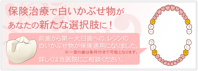 レジンの白い被せ物が該当箇所のみ保険適用となりました。　詳しくは当医院にご相談ください。